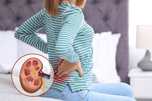 A woman with hands on her back, apparently in pain. An inset illustration of the kidney is in the lower left corner.
